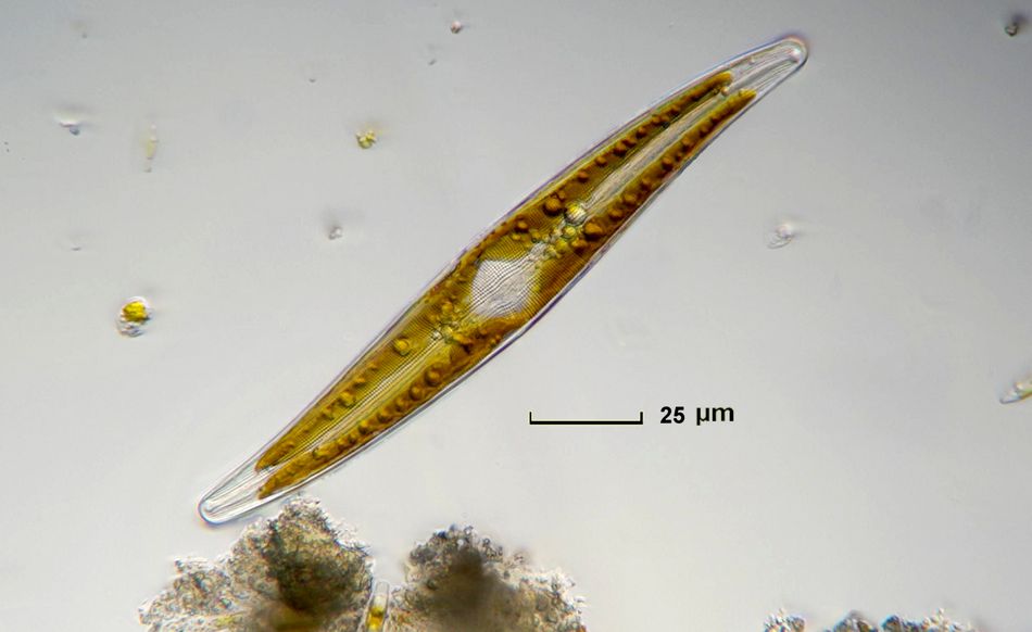 Fragilaria [ Gyrosigma sp. ]